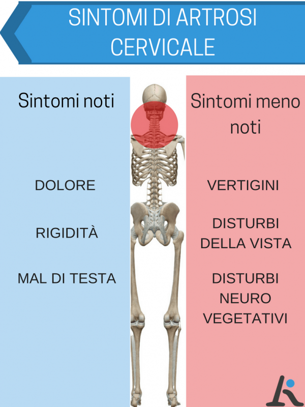 Artrosi Cervicale Sintomi Quali Sono E Come Risolverli