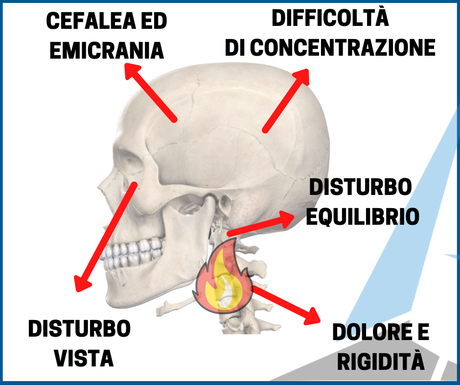 Camerani Osteopatia Roma - Cervicale: sintomi, cause, cure e rimedi Il  dolore cervicale (o cervicalgia) si configura come un dolore localizzato in  corrispondenza del collo, che spesso si irradia verso braccia e