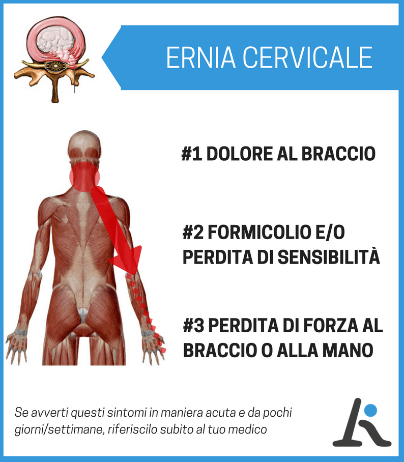 Ernia Cervicale 3 Sintomi Da Conoscere Assolutamente Tutti Gli Altri 4238