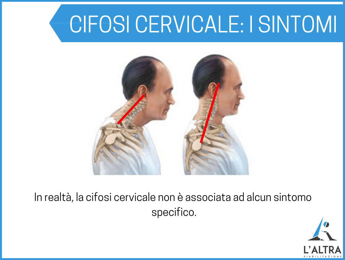 Cifosi cervicale cosa fare se il tuo collo si è girato al contrario